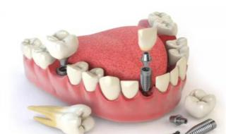 种植多少钱一颗